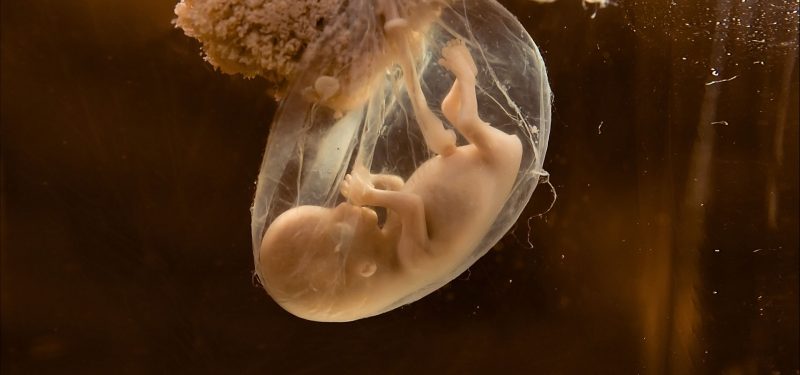 Αμνιακό υγρό: Τι είναι και γιατί είναι σημαντικό Αμνιακό υγρό: Τι είναι και γιατί είναι σημαντικό